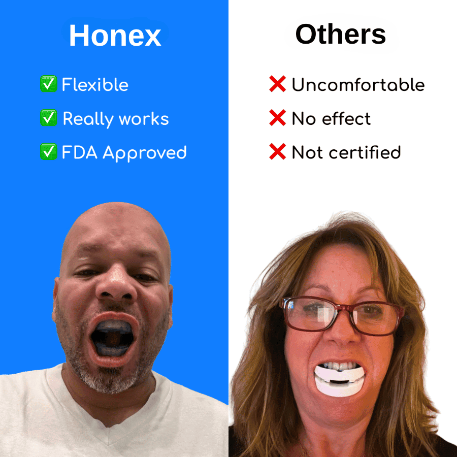 Honex Silent Sleep Snore Guard