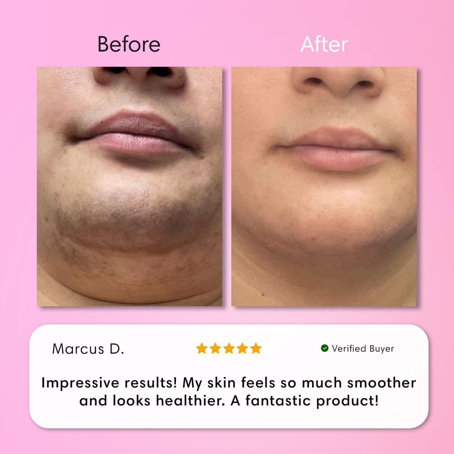 Opulenza Smooth Skin Kit