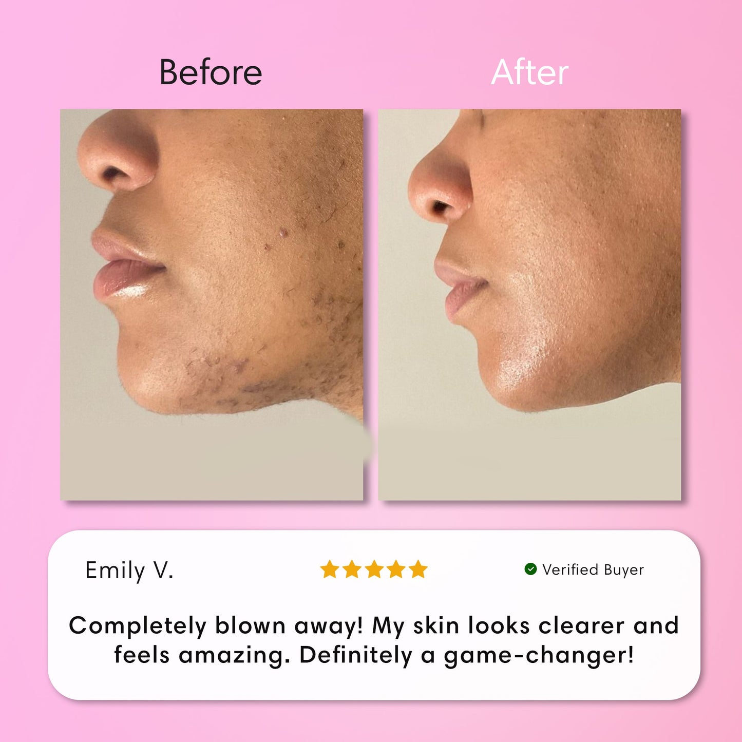Opulenza Smooth Skin Kit