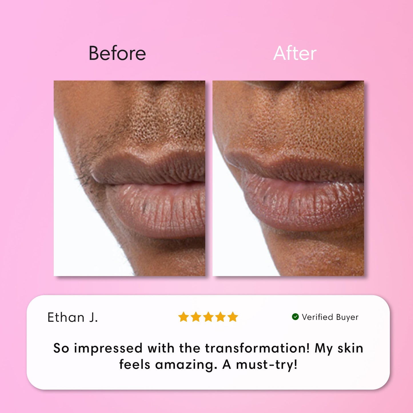 Opulenza Smooth Skin Kit