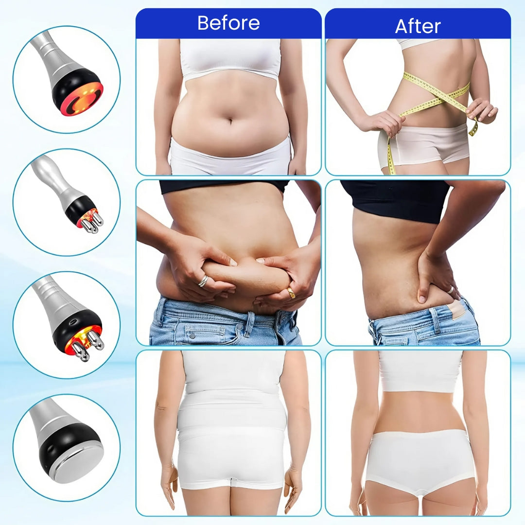 Shape & Tone Cavitation Device