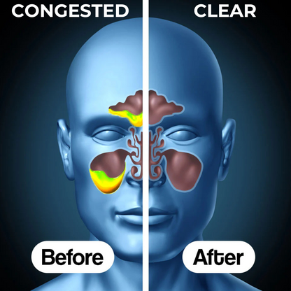 Nose Clear Sinus Relief